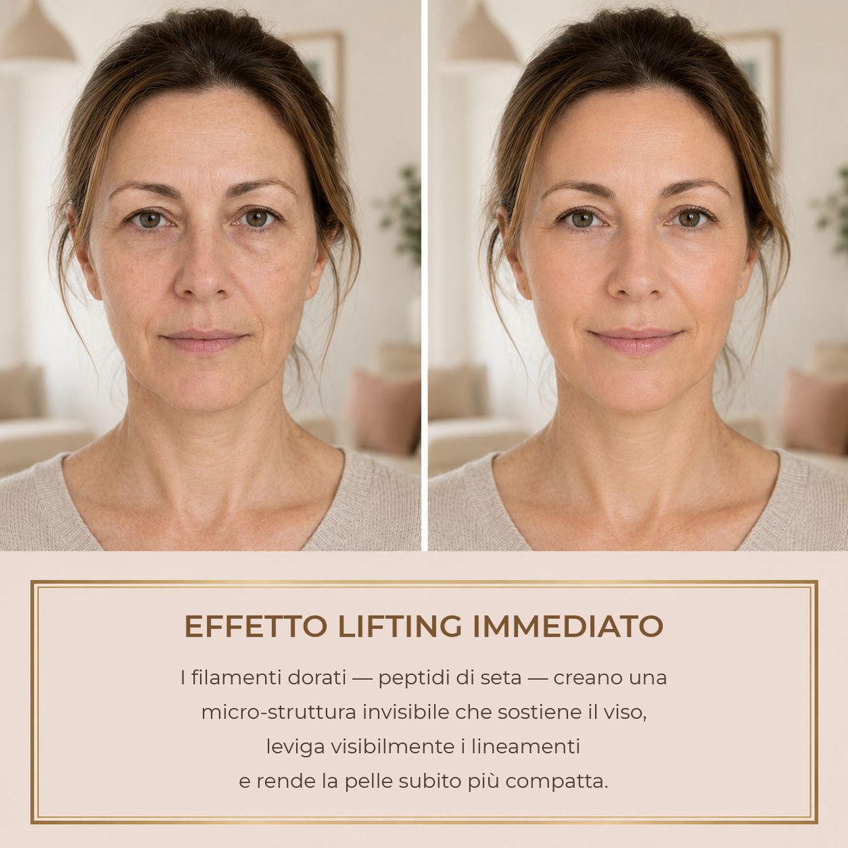 Effetto lifting immediato – prima e dopo