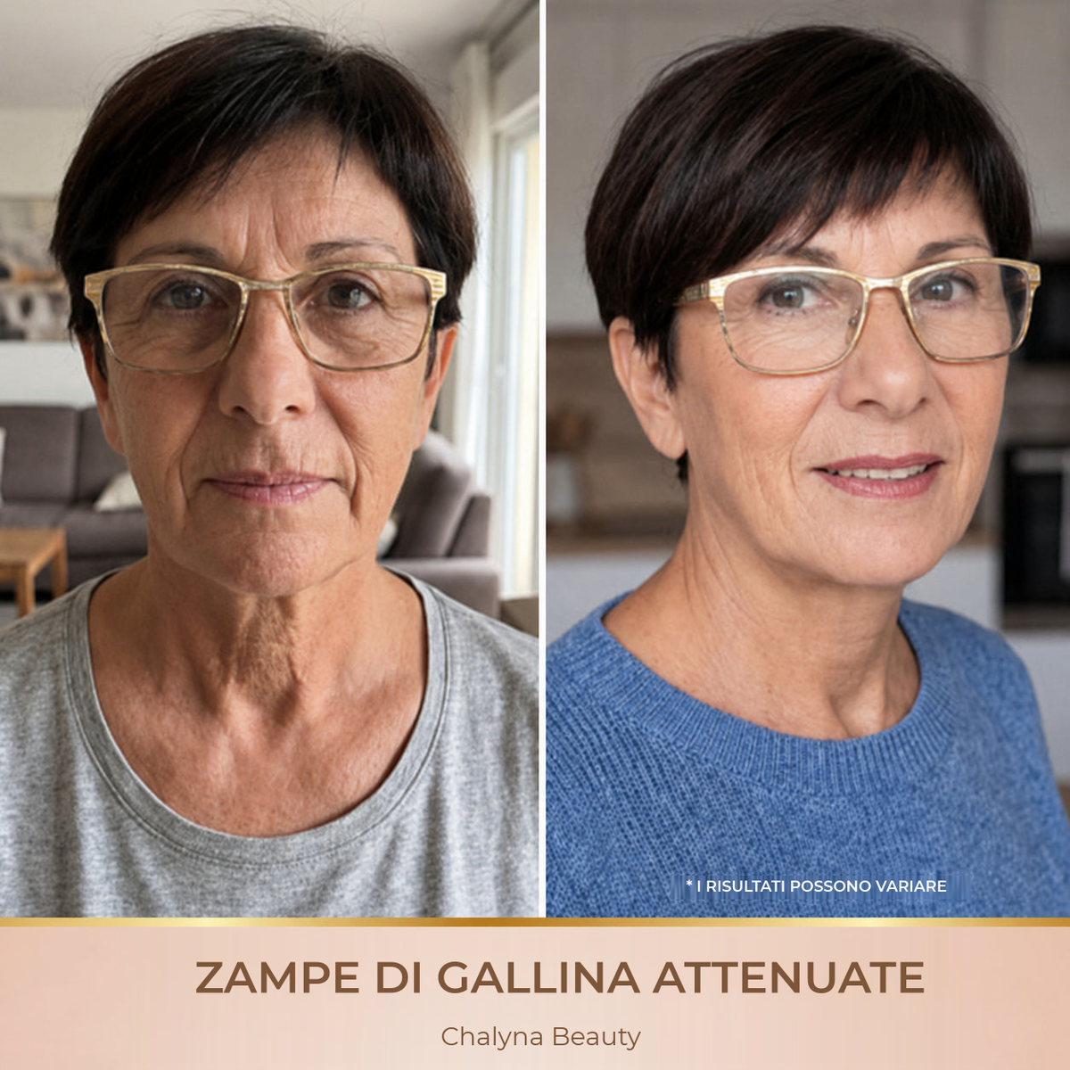 Zampe di gallina attenuate
