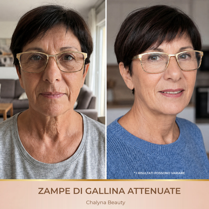 Zampe di gallina attenuate