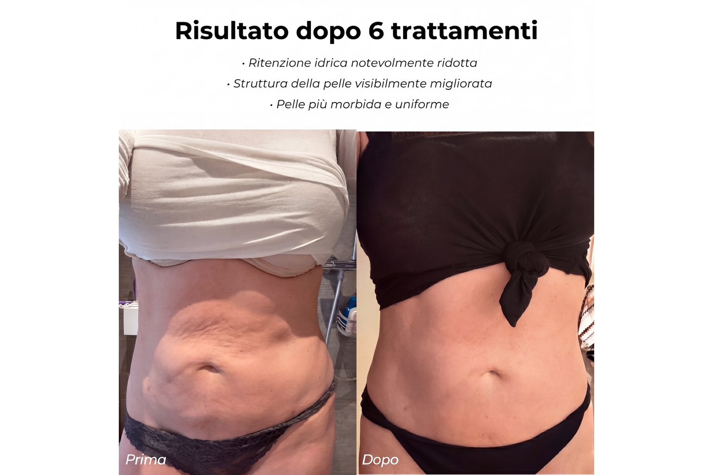 CorpoLuce™ - Massaggiatore anticellulite