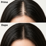 Prima e dopo risultati Rigenera
